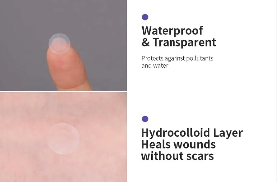 a.l.m. Magical Patch (2) Hydrocolloid pimple patches. These ultra thin & translucent hydrocolloid adhesive covers and absorb unwanted pimples. Parches Para Acne for skincare.
