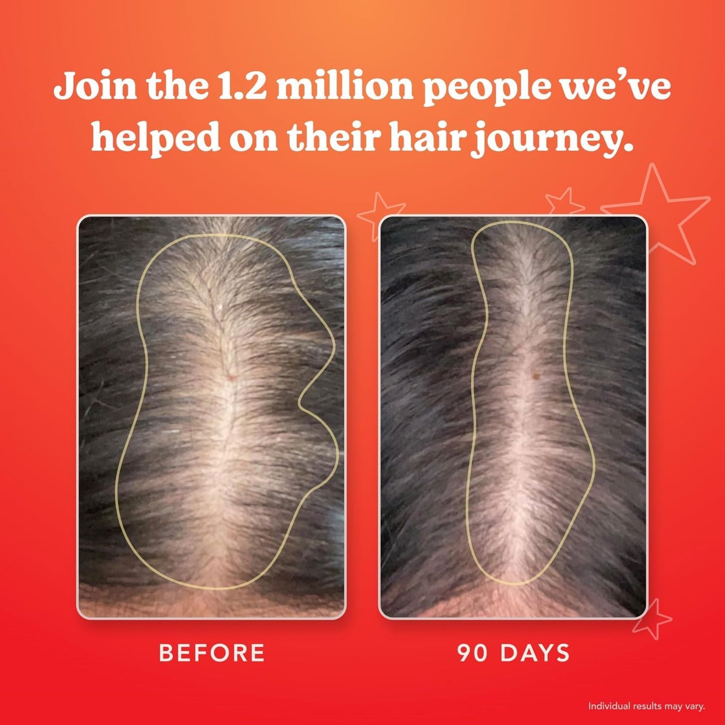 HAIRtamin Advanced Formula Hair Growth Supplement for Women & Men, Supports Stronger, Longer, Visibly Thicker Hair, With 5000 mcg Biotin, Vitamins & Antioxidants, 100% Vegan – 3 Month Supply