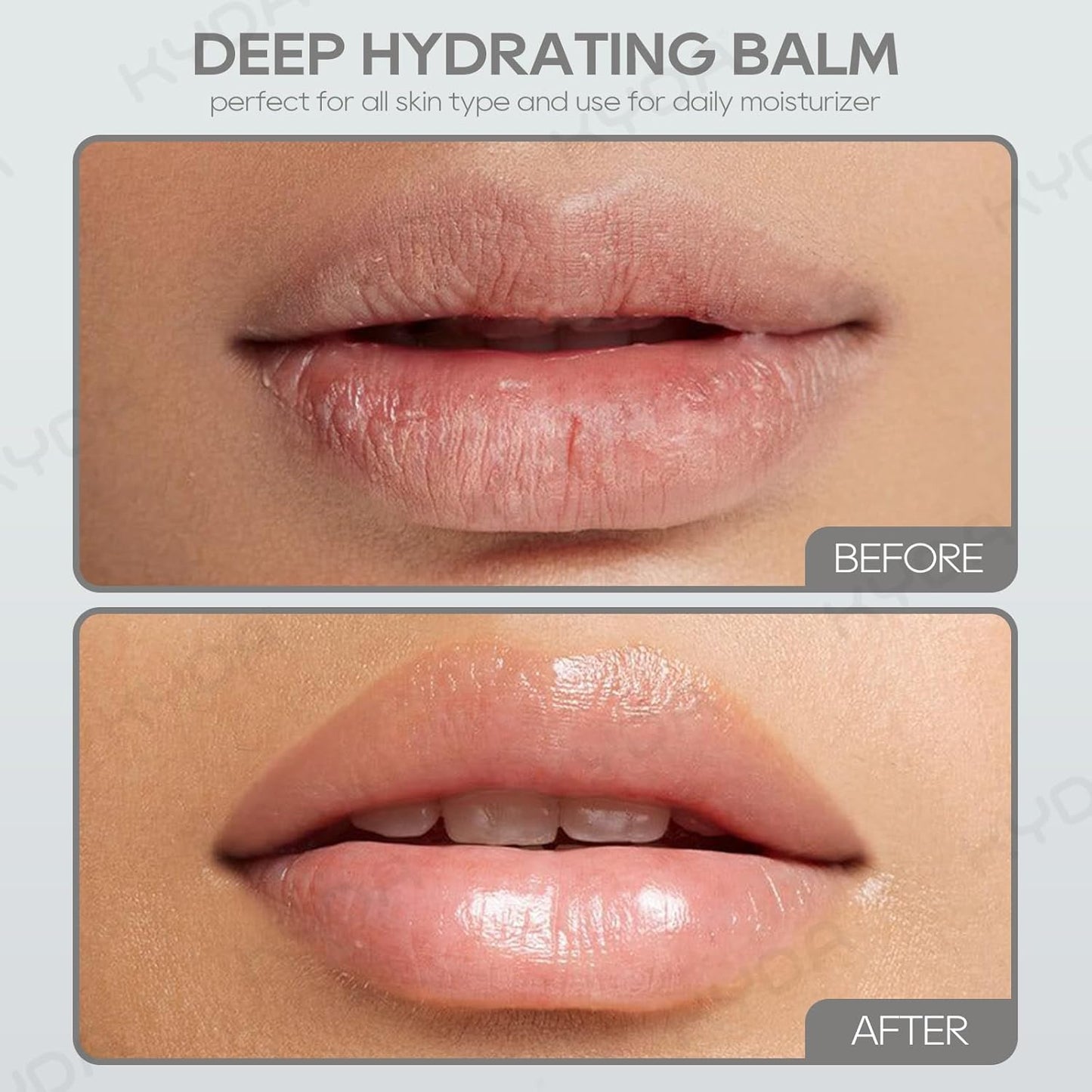 KYDA 3 Pcs Milk Moisturizing Lip Balm, Nourishes, Hydrates and Softens Dry Cracked Lips, Reduce Fine Lines, Deep Hydrating Lip Care Balm, Colorless Finish