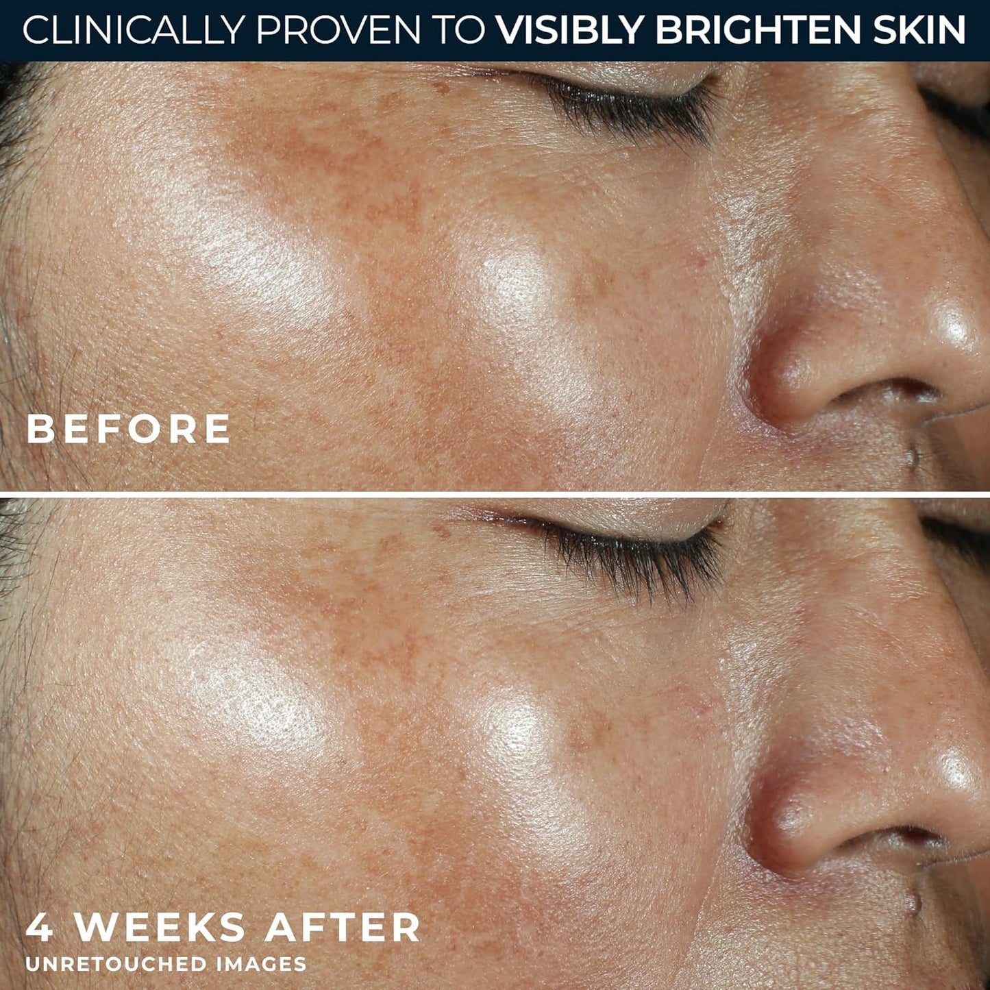 RoC Multi Correxion Revive + Glow Vitamin C Sunscreen Broad Spectrum SPF 30 Face Moisturizer (1.7 oz) with Retinol Eye Cream Packette