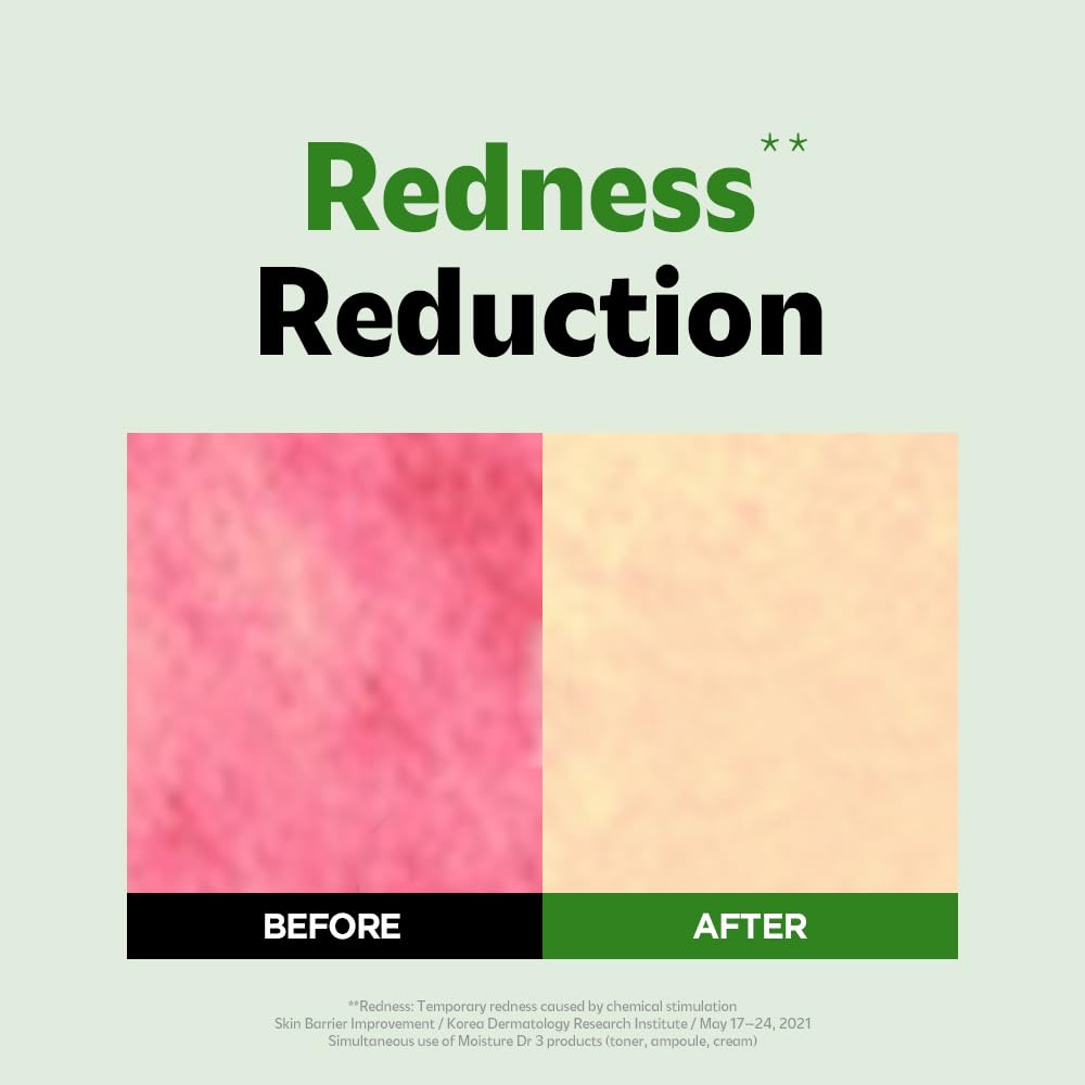 ISOI Moisture Dr. Soothing Cream, Deep Hydration & Barrier Support with Hyaluronic Acid, Lightweight Moisturizer for Sensitive Types, Korean Skin Care (2.37 fl.oz, 70ml)