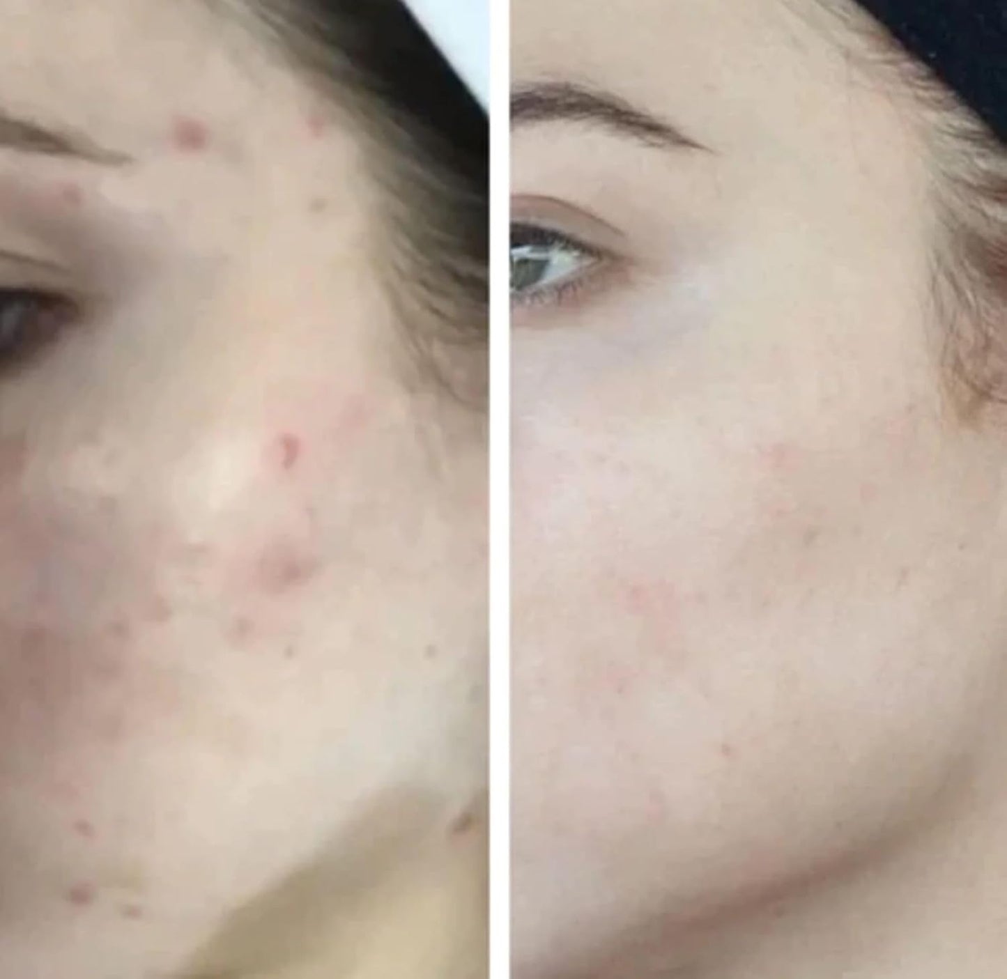 HigherDOSE Light-Activated GLOW SERUM - Anti Aging Face Serum to Plump, Hydrate & Smooth Fine Lines - Made with Vitamin C, Copper Peptides & Hyaluronic Acid - Boosts Benefits of Red Light (1 oz)