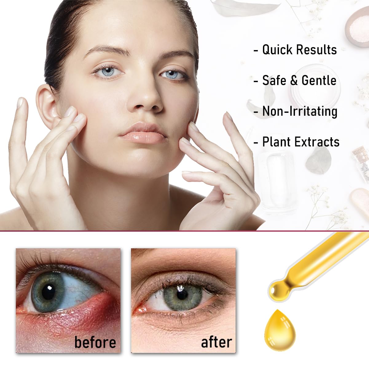 Stye Eye Treatment,Chalazion Remover,Stye Eye Relief Serum for Styes Chalazion and Blepharitis Treatment, Fast Relief,Mild Lash and Eye Cleanser