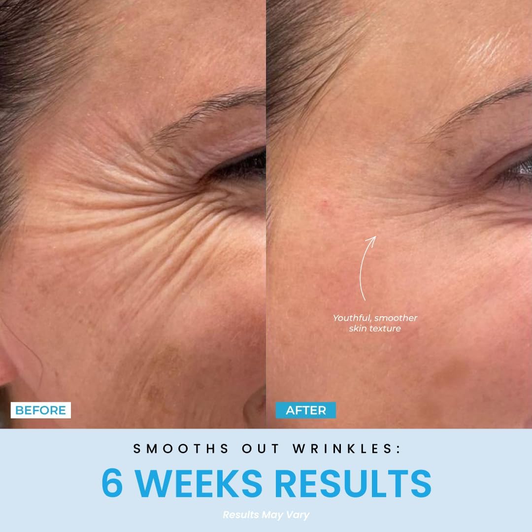 Red Light Therapy Face & Neck Massager – LiftLab 3-in-1 LED Sculptor with Blue & Green Modes – Jawline & Double Chin Tightening, Wrinkle & Spot Care -Improved Battery