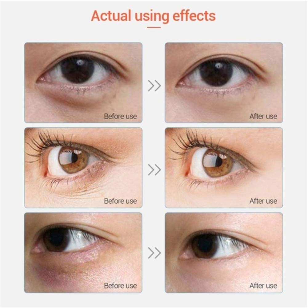 Adofect 30 Pairs Pink Eye Mask Collagen Eye Gel Pads Under Eye Patches Mask for Puffiness and Dark Circle Under Eye Patches for Women and Men