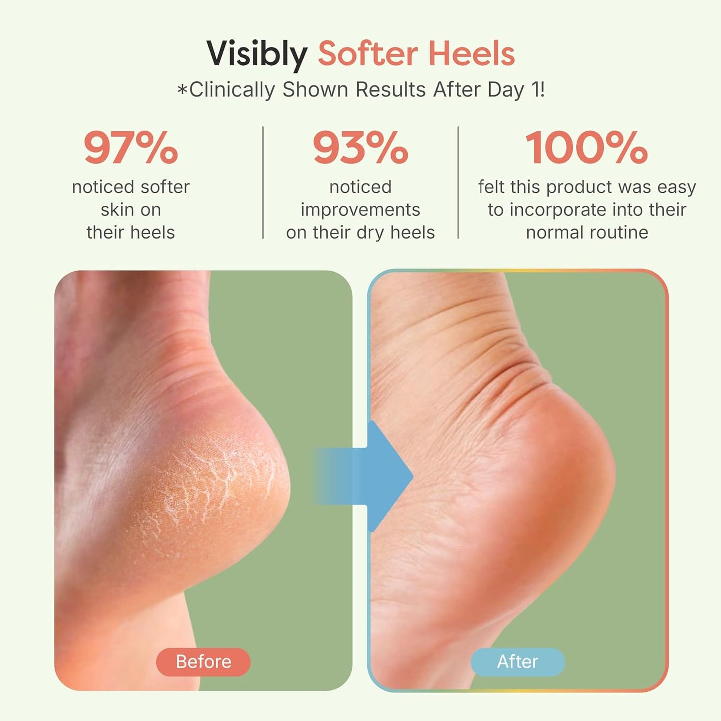 ZenToes Moisturizing Socks for Cracked Heel Treatment - Vitamin E, Olive Oil and Jojoba Oil Infused Heel Socks to Soften and Hydrate (Fuzzy Mint Green, Regular)