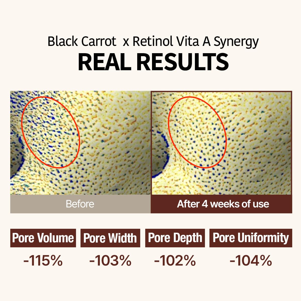 GOODAL Black Carrot VITA-A Retinol Ampoule 30ml, Hydration Facial Serum for Glowy Skin, Lightweight Serum, Korean Skincare, Pore minimizer