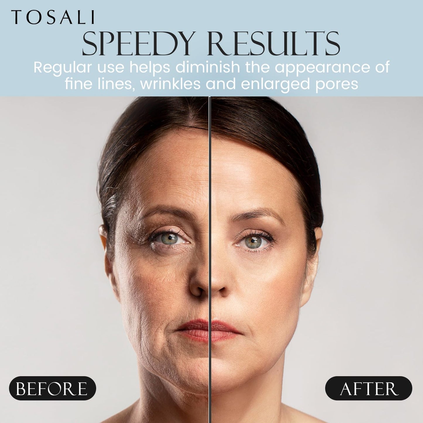 Anti Aging Daily Peeling Face Exfoliator – Peeling Gel with Hyaluronic Acid, Lactic Acid & Vitamin E, Gentle Exfoliating Gel for All Skin Types, Skin Care for Women, 6.8 Oz