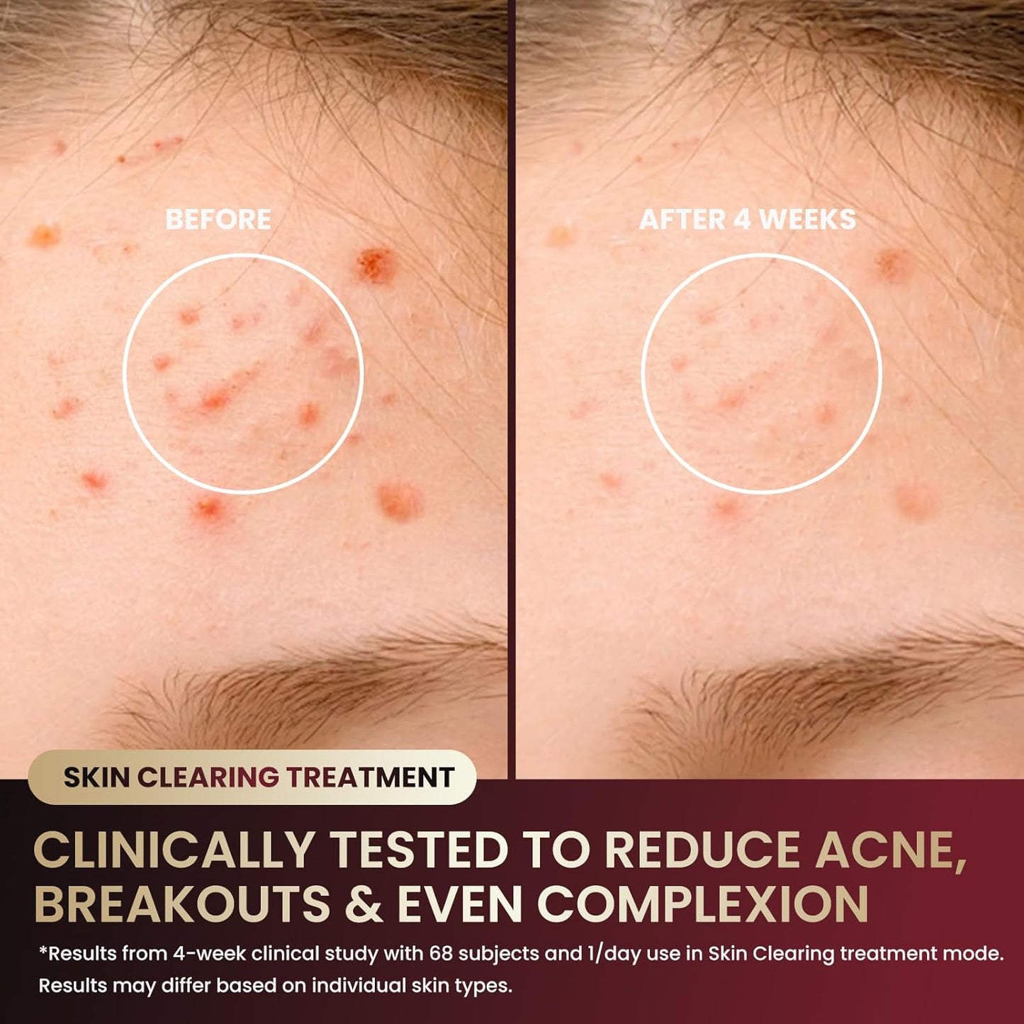 FDA-Cleared Red Light Therapy for Face with 7 Modes & 432 Medical Grade LEDs | LED Face Mask Light Therapy Targeting Anti Aging, Wrinkles & Acne | at-Home Skin Tightening & Collagen Boost