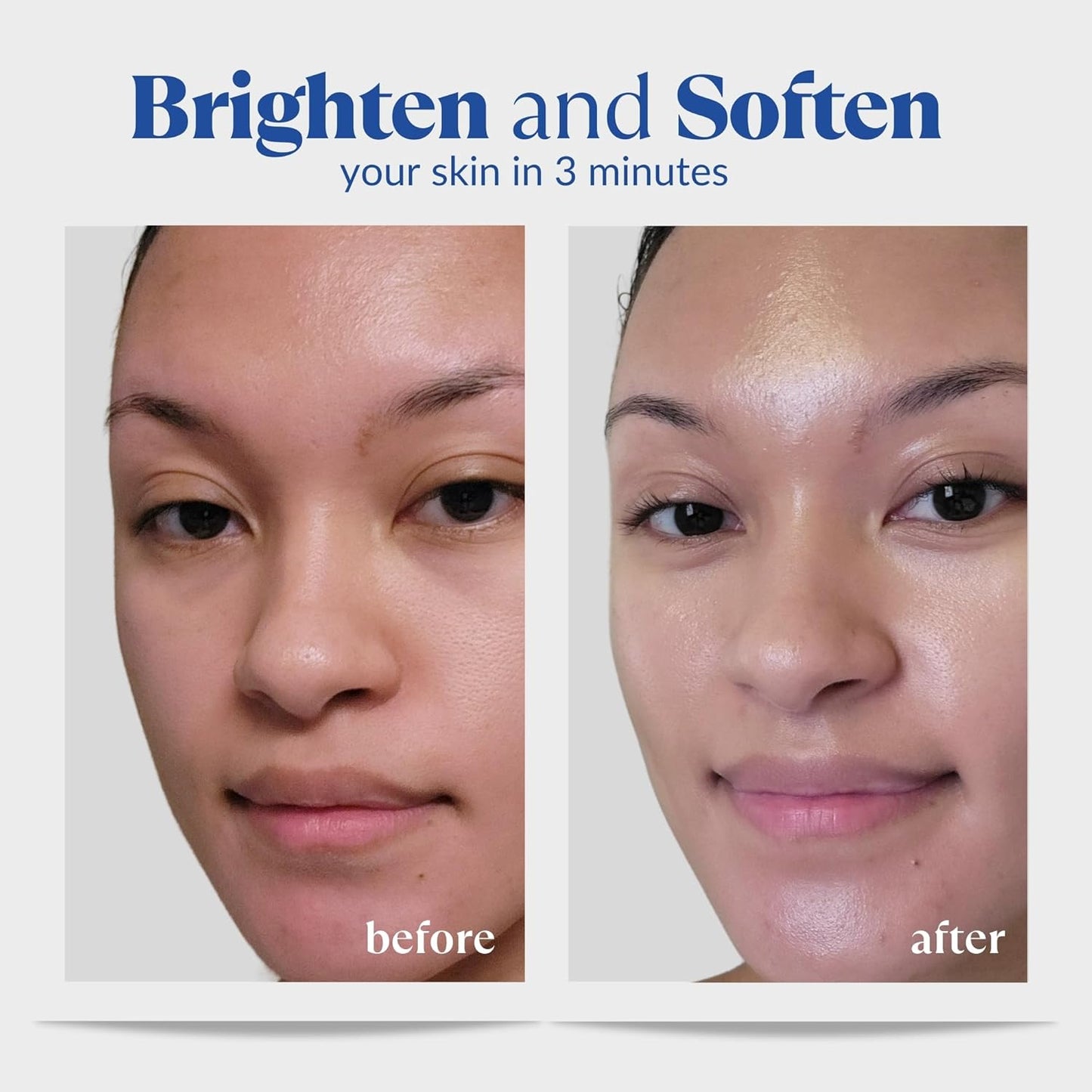 Cure by Toyo | Aqua Gel Gentle Exfoliator | Clear and Softer Skin | Non-Abrasive Face and Body Cleanser | Sensitive Skin | Big Size 8.82oz