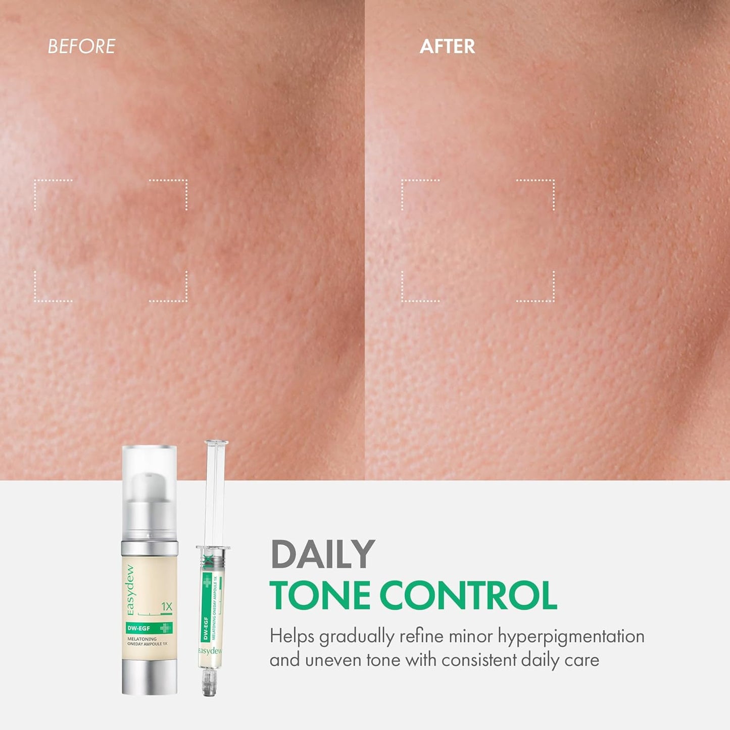 Easydew DW-EGF Melatoning Ampoule 1X - Hydrating Dark Spot Serum with Niacinamide & Glutathione for Uneven Skin - Fast Absorbing Day & Night Ampoule Korean Skin Care (Pump 0.27 fl oz, EGF 1X)