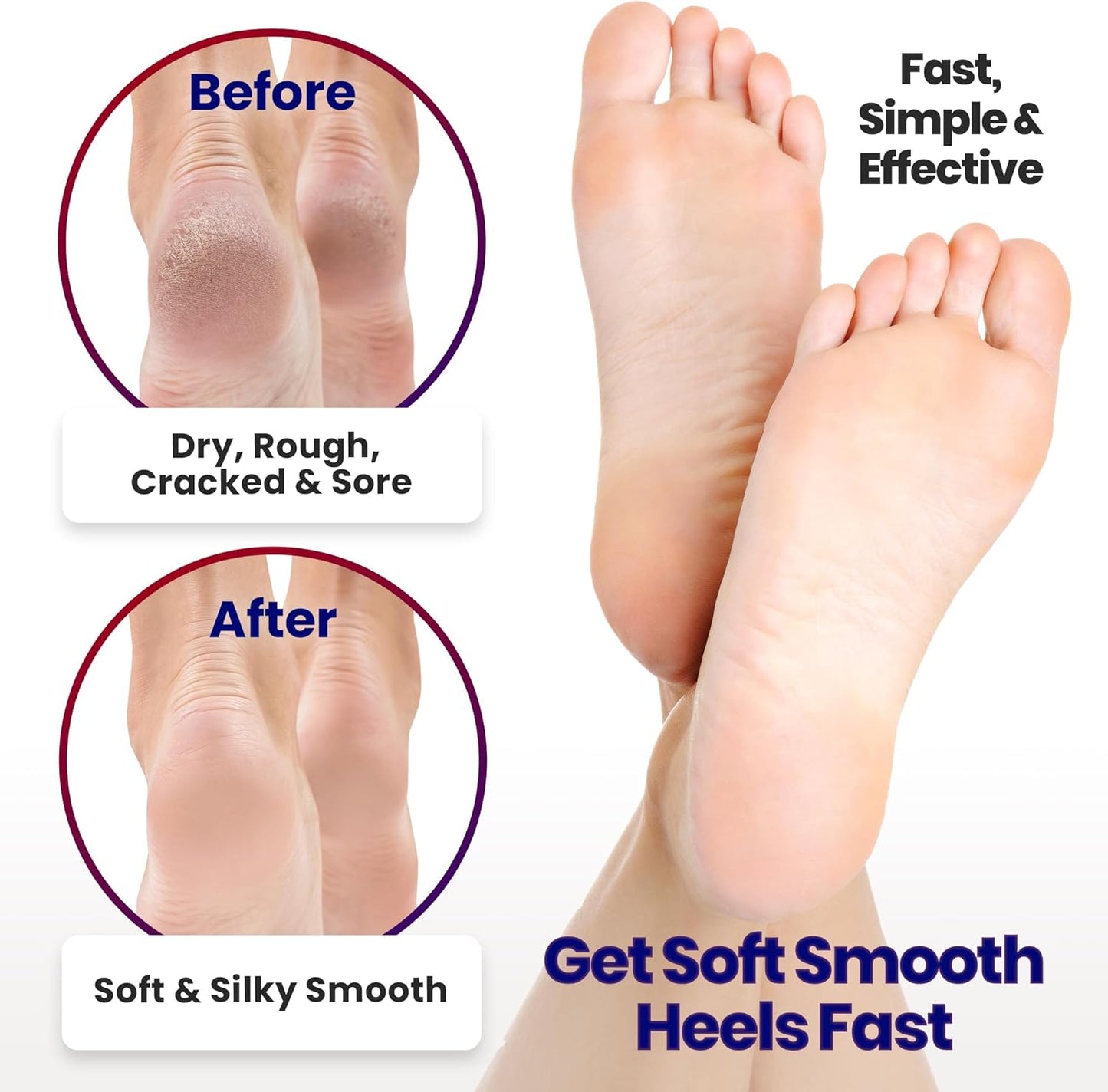 Moisturizing Socks for Women & Men | Cracked Heel Treatment with Aloe Vera | Moisturizer Foot Callus Remover | Aloe Socks for Cracked Heels & Dry Rough Feet, Lotion Infused Gel Heel Sleeves Fits Most