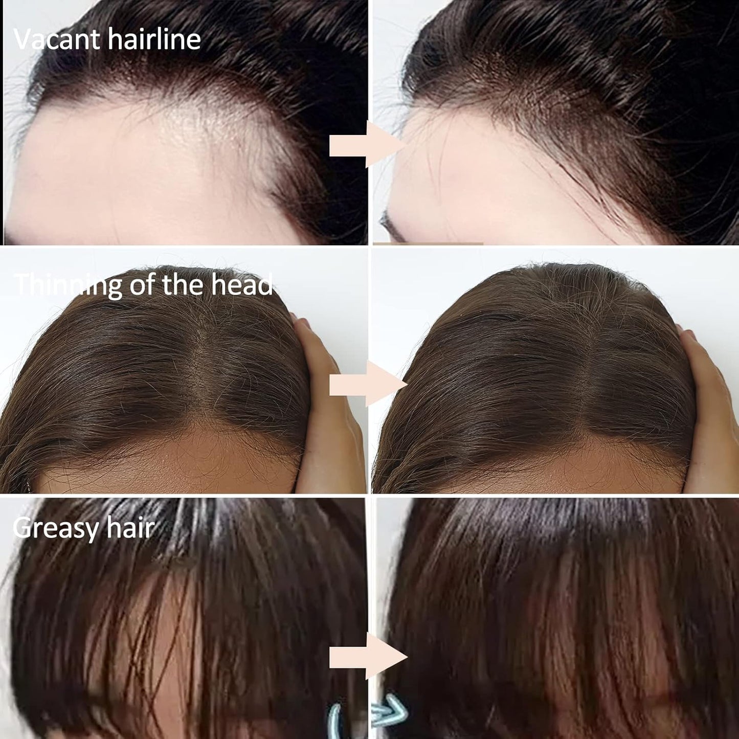 Boobeen Root Touch Up Powder for Hair Shadow, Cover Hair Loss Instantly, Hairline Powder for Women and Men