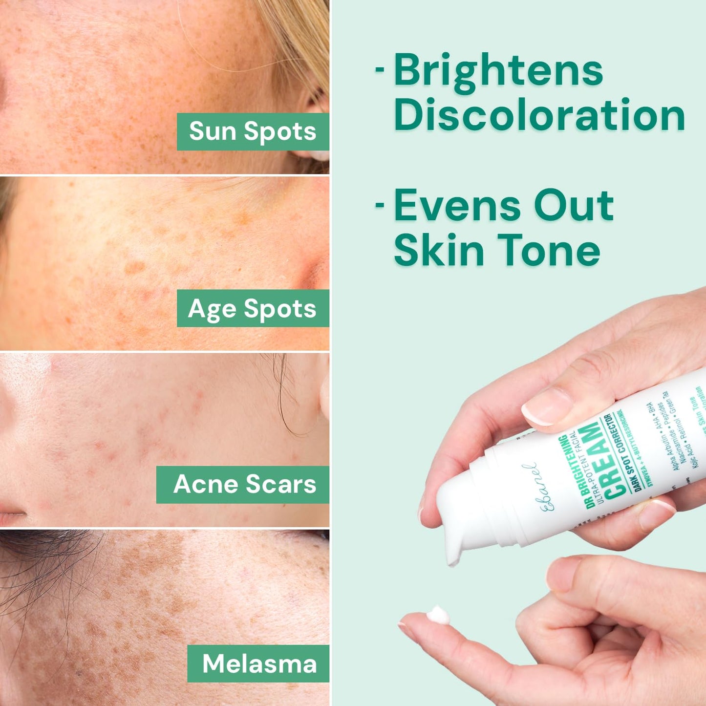 Ebanel Dark Spot Remover for Face & Body, Skin Brightening Cream with Synovea, Alpha Arbutin, Niacinamide, Kojic Acid, Dark Spot Corrector for Hyperpigmentation, Discoloration, Melasma, and Age Spots