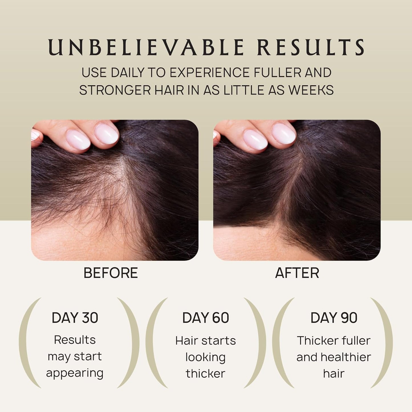 Hair Growth Oil Spray - 100% Pure Ingredients For Non Greasy, Thicker & Stronger Hair - Organic Batana, Castor, Biotin, Saw Palmetto, and Rosemary Oil for Men & Women Scalp - 4 FL OZ