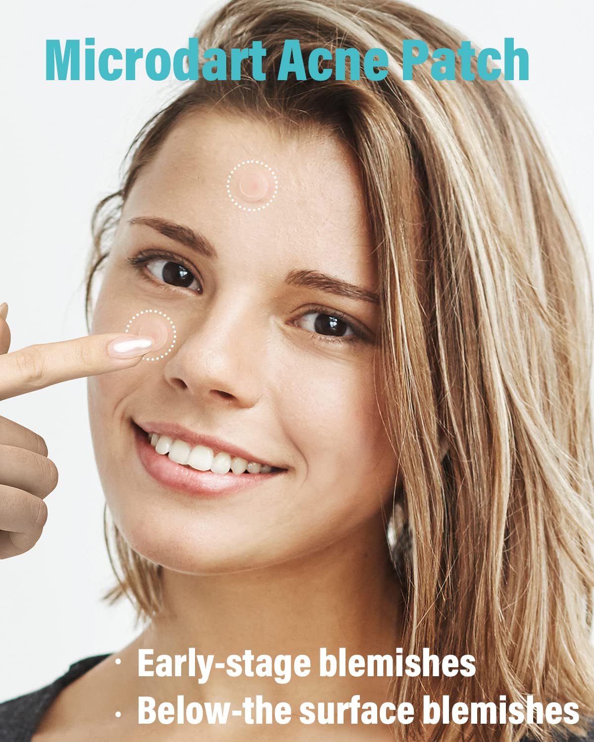 Microdart Acne Patch (9 Patches) - Hyaluronic Acid & Salicylic Acid Hydrocolloid Pimple Patch for Deep, Early and Hidden Blemishes (9 Count (Pack of 1))