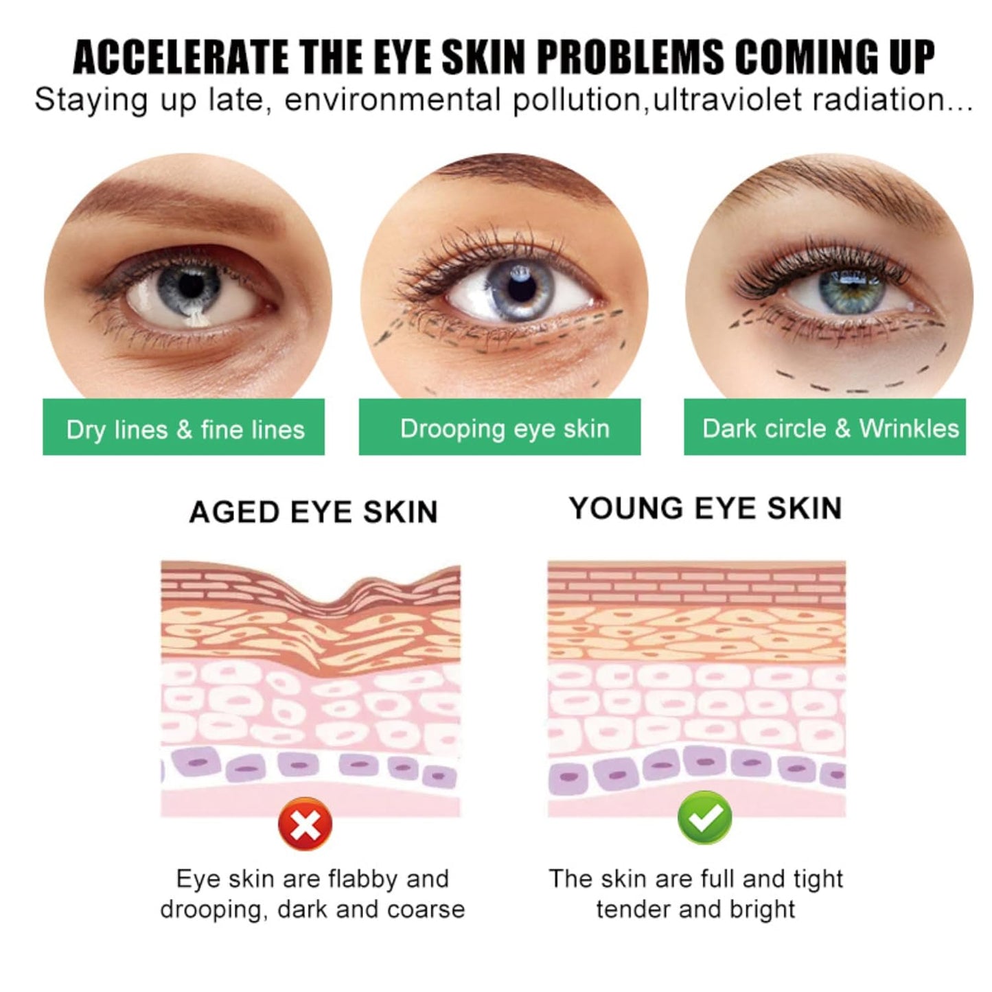 SORYA Eye Cream Remove Dark Circles Puffiness, Eye Bags Wrinkles Fine Lines, Under-Eye Bags Anti-Aging Collagen Revitalize Your Look with Our Advanced Formula for a Youthful Glow