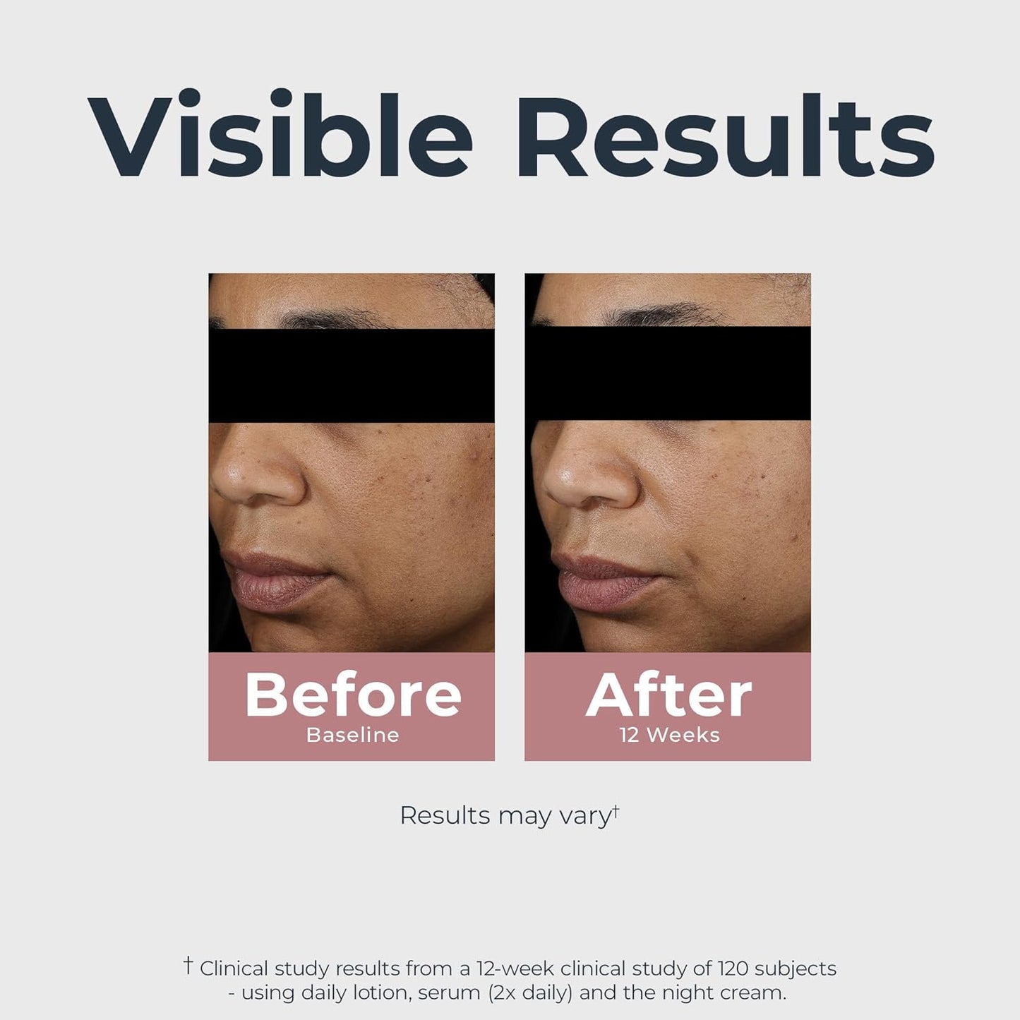 Eucerin Radiant Tone Night Cream, Dark Spot Corrector with Thiamidol, Night Moisturizer for Face Helps Visibly Reduce the Look of Persistent Dark Spots, All Skin Types, 1.7 Oz Bottle