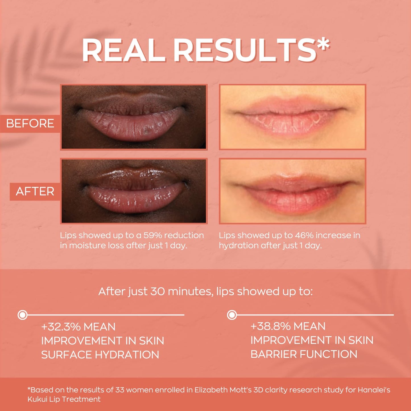 Hanalei Hydrating Lip Treatment Balm – Cruelty-Free, Paraben-Free Moisturizer for Severely Dry, Chapped Lips – Kukui Oil, Shea Butter & Grapeseed Oil – Clear Tint, Travel-Size 3-Pack (5ml X 3)