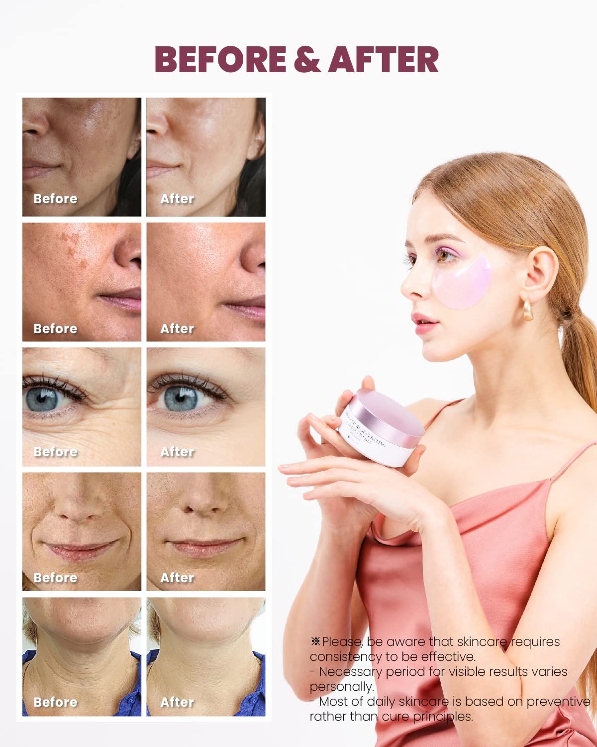 KSECRET Advanced Regenerating Eye Gel Patches, 102g/3.45oz. 60pcs (15 full pairs) with RETINOL | Korean Skincare | Under Eye Masks for Anti-Wrinkles, Anti-Aging, Dark Circles, Puffiness…