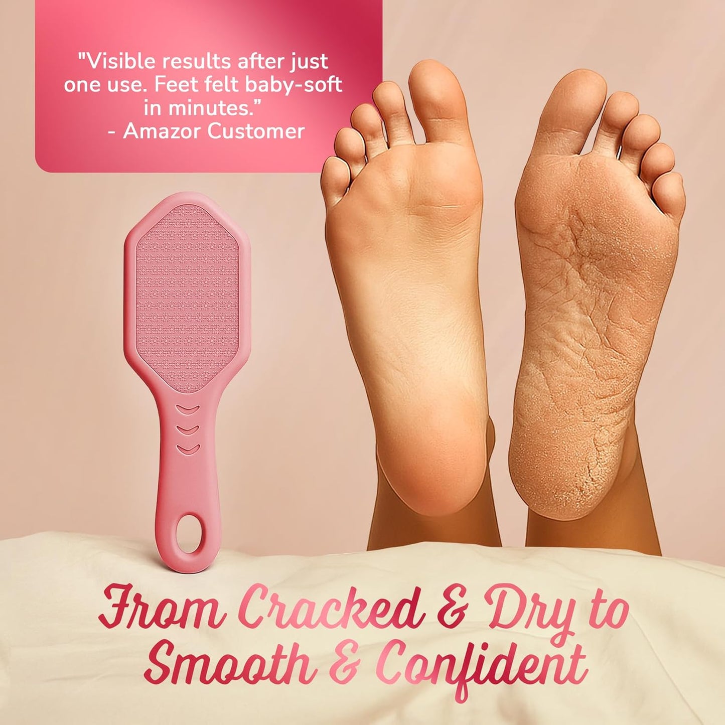 Silicone Foot Callus Remover - Nano Glass Foot File for Dead Skin and Cracked Heels - Callus Remover for Feet & Hard Skin - Ergonomic Foot Scrubber & Exfoliator for Soft, Smooth Feet - Pink