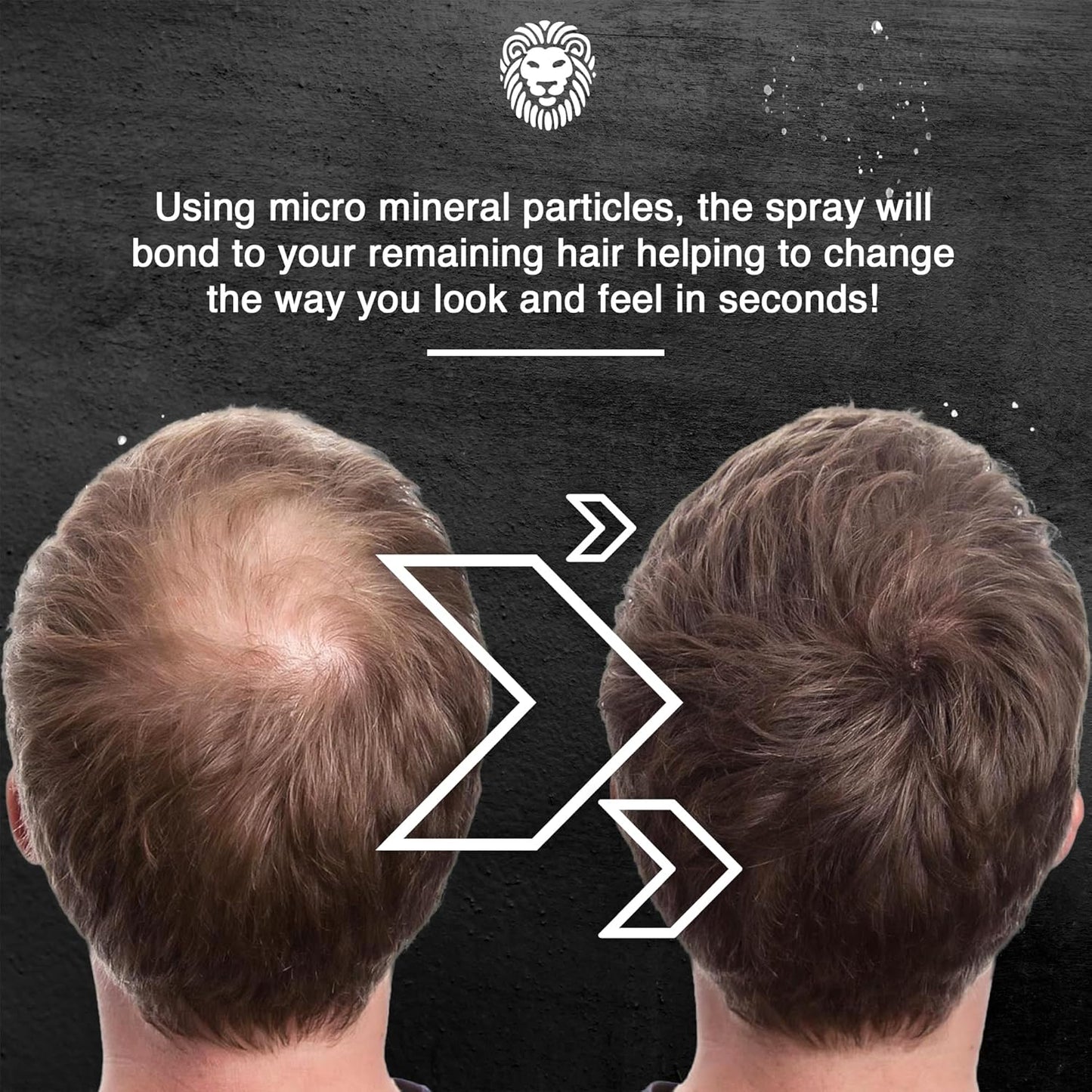 Mane Hair Thickening Spray & Root Touch Up, Instantly Thicker Hair for Men & Women, Fill in Hairlines and Hide Thinning and Fine Patches - Light Brown, 12 Colors (6.76 oz)