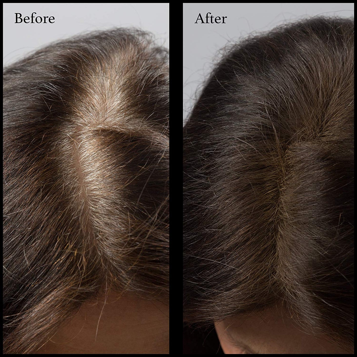 Root Touch Up Powder - True-to-Nature Hairline Concealer with 11 Shades - Fragrance-Free, Talc-Free, Paraben-Free (With Brush, Dark Brown)