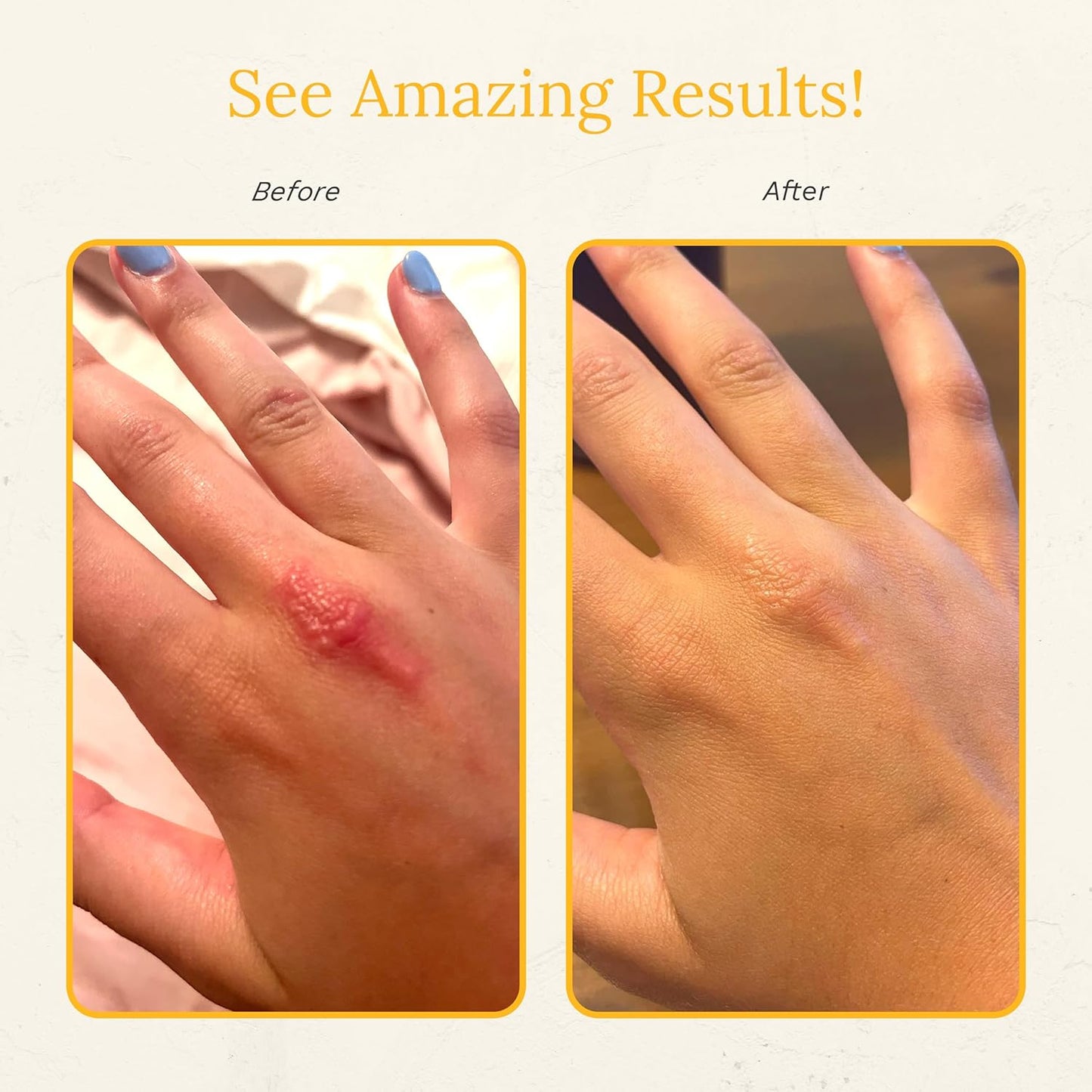 Rejuvaskin Skin Recovery Cream with Aloe Vera, Cooling Moisturizing Cream for Dry, Itchy & Sensitive Skin, 100 ml