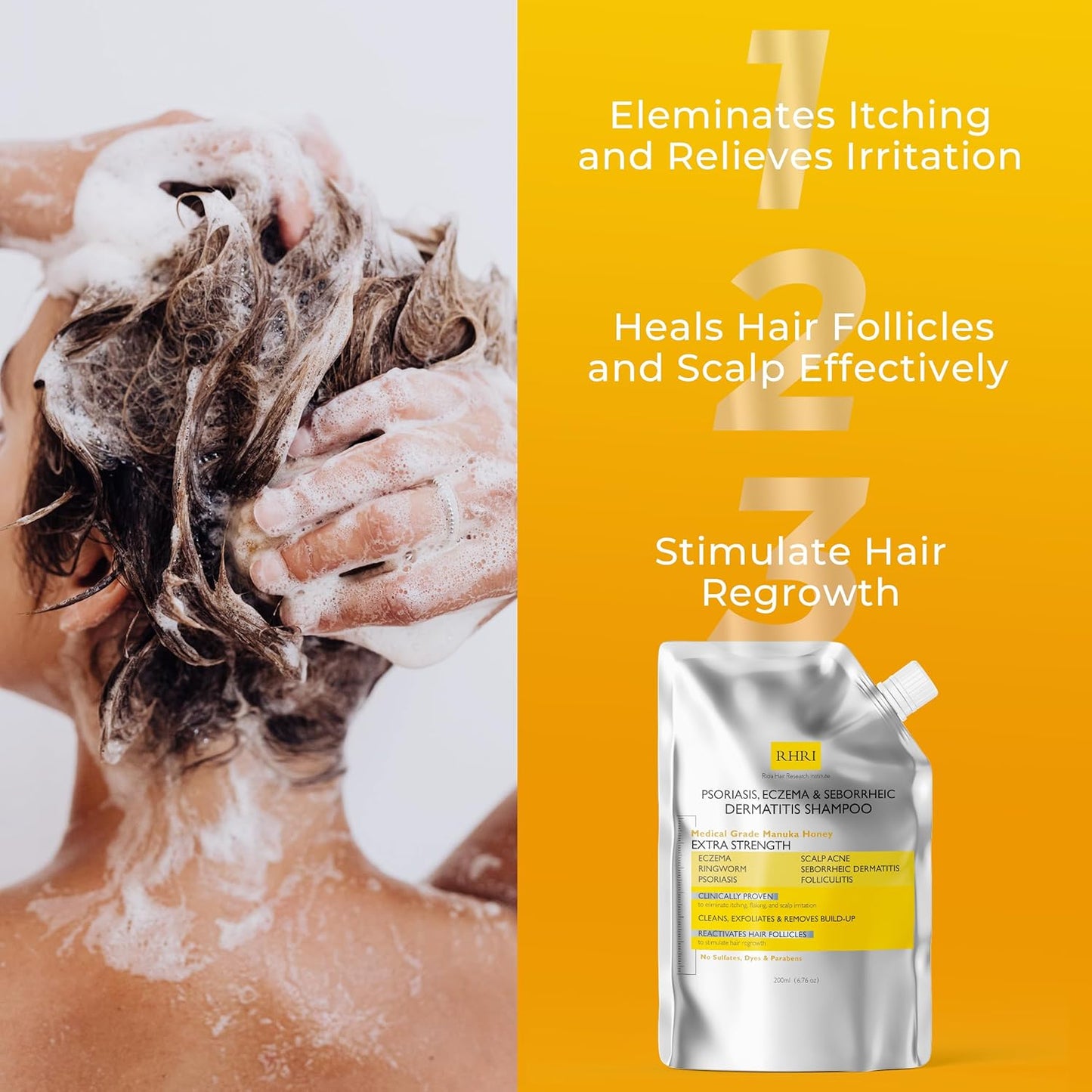 Antifungal Psoriasis Shampoo, Eczema, Seborrheic Dermatitis Shampoo | Soothes Itching, Flaking & Irritation | Repairs Scalp, Strengthens Hair, Stimulates Regrowth | Medicated Scalp Treatment