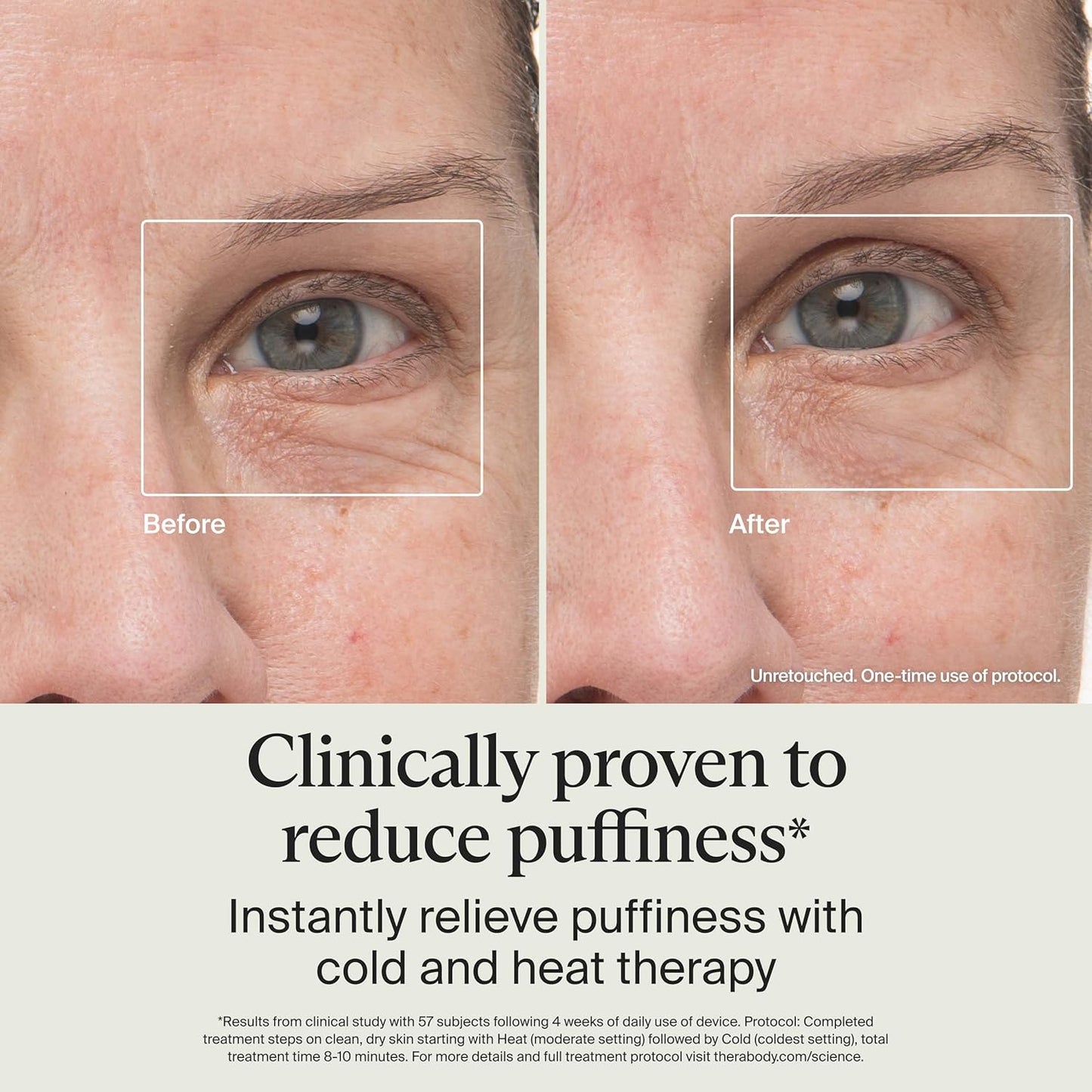 Therabody TheraFace Depuffing Wand – Cold and Heat Skincare Treatment to Depuff and Glow; Beauty Wand, Face Roller and Eye Massager for Eye Puffiness, Dark Circles and Skin Radiance (White)