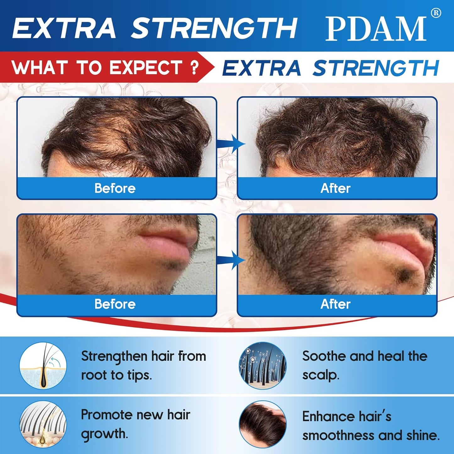 Minoxidil for Men Hair Growth Spray - 5% Topical Minoxidil for Hair and Beard Growth, Extra Strength Hair Regrowth Treatment for Hair Loss & Thinning Hair, 2 Fl Oz (60ml) *3