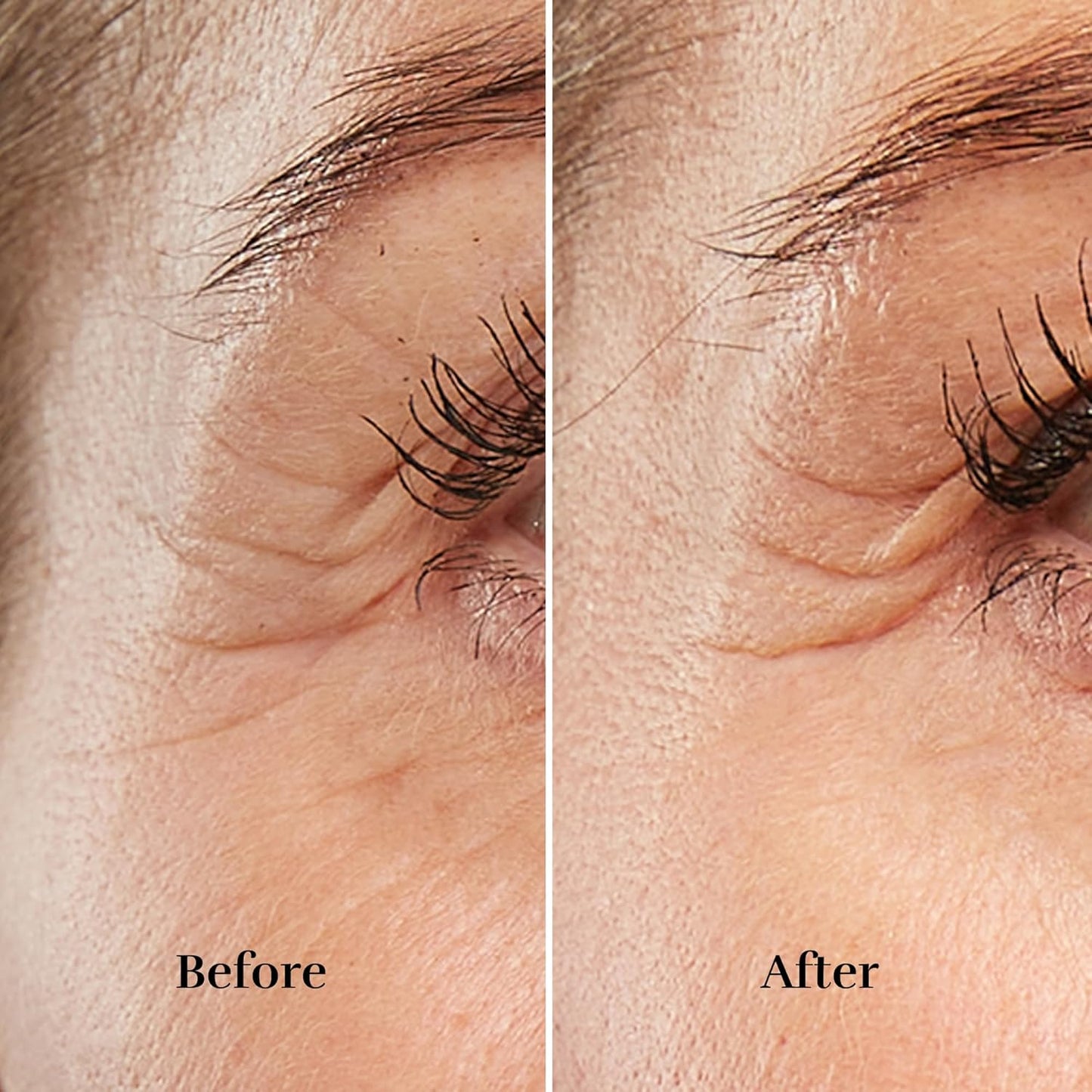 Silk’n Anti-Aging Device - Titan Mini - Wrinkle Reduction and Skin Tightening - Rejuvenates Skin on Smaller Face Areas - Cordless Use - Skin Care Device with LED - Unisex Hygiene and Personal Care