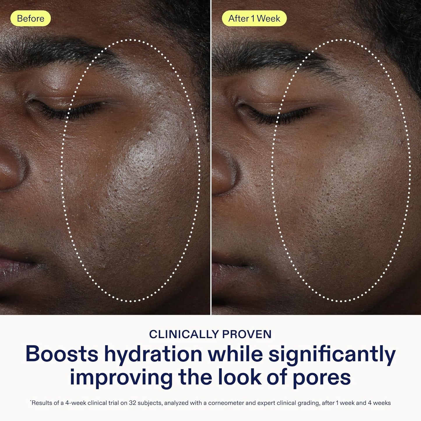 Skinfix Barrier Balancing Water Cream - 1.7 oz - Fast-Absorbing, Weightless Moisturizer for Combo + Oily Skin - Acne-Safe, Non-Pore-Clogging - Non-Comedogenic - Fragrance Free - Vegan, Cruelty Free