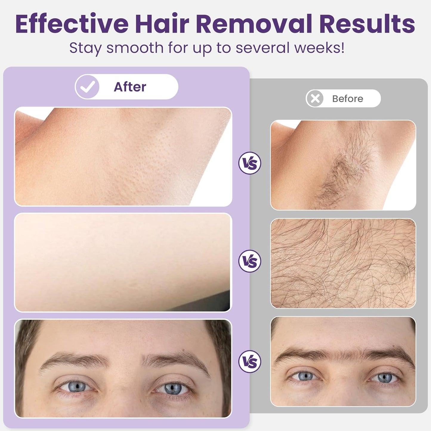 Sunvivi Wax Kit Digital Hair Removal Waxing Kit for Women & Men, Hot Wax Warmer Pot with 5 Bag Hard Wax Beads, Wax Melt Warmer Kit for Full Body, Legs, Face, Bikini,Sensitive skin, Pink