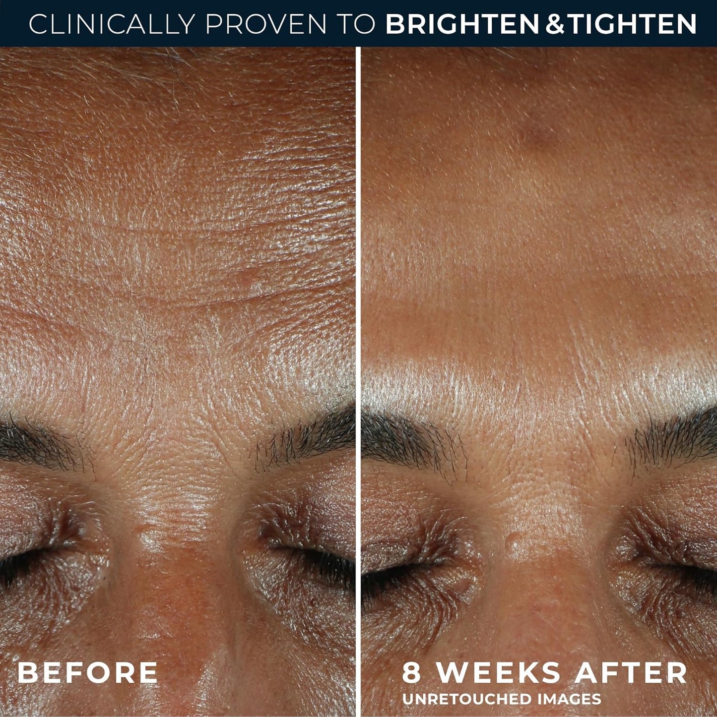 RoC Multi Correxion Revive + Glow 10% Active Vitamin C Serum for Face, Daily Anti-Aging Wrinkle and Skin Tone Skin Care Treatment, Brightening Serum , 1 Fluid Ounce