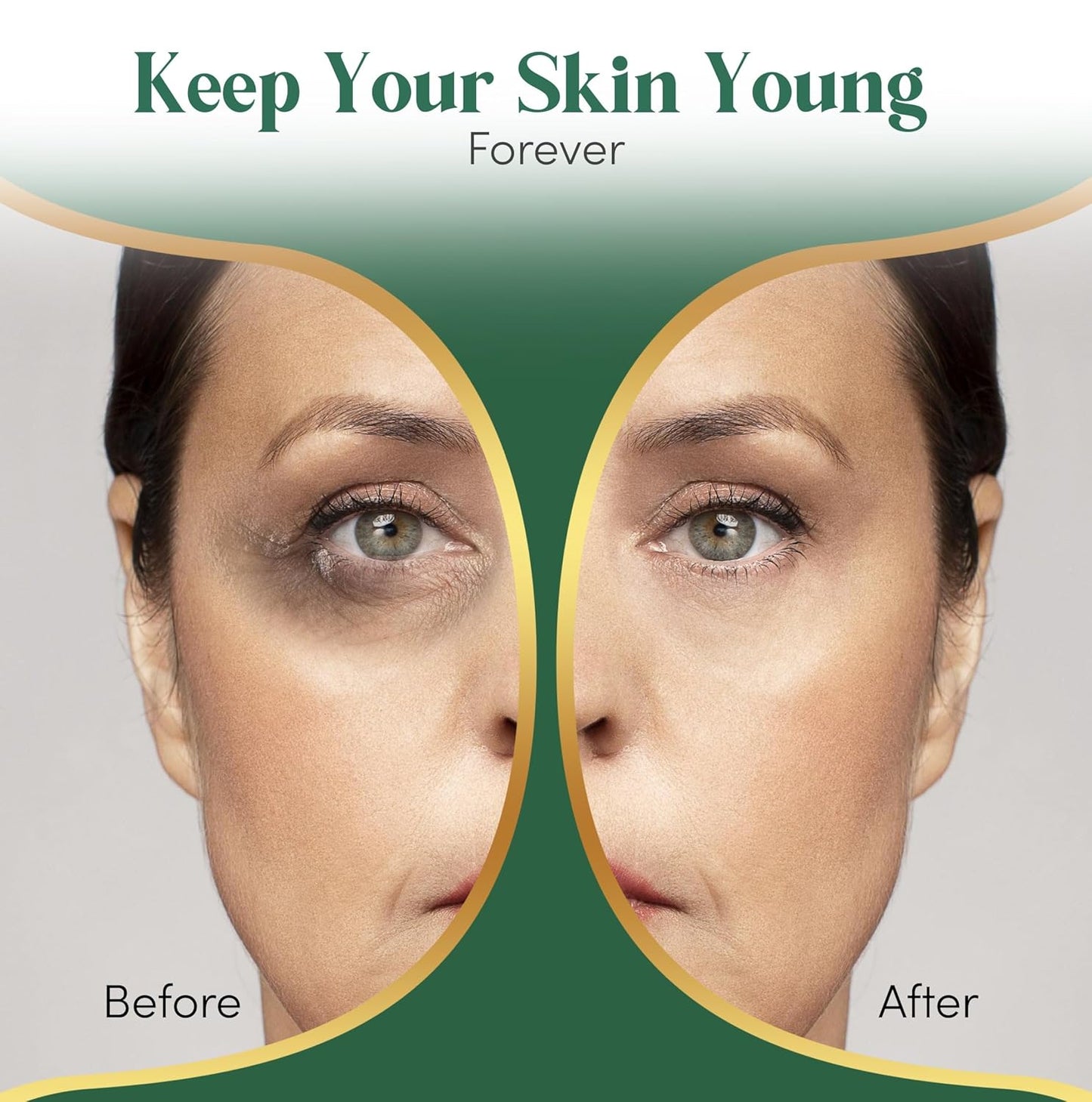 24K Gold Under Eye Patches For Puffy Eyes (36 Pairs) - Collagen Enriched Under Eye Masks for Dark Circles and Puffiness, Hyaluronic Acid Under Eye Mask Patches for Wrinkles